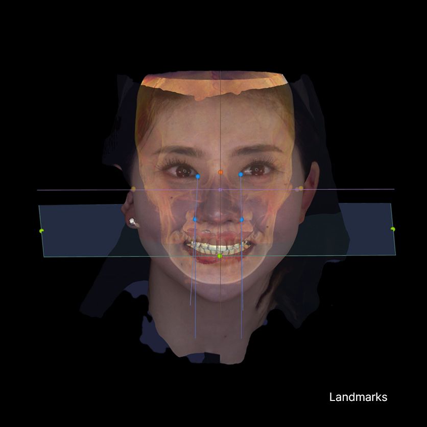RAYFace
