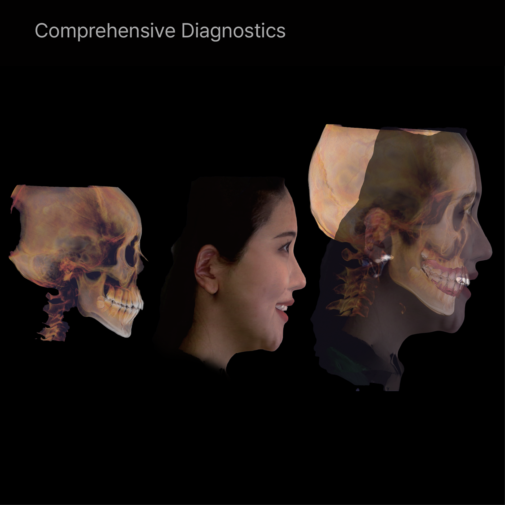 Rayscan Vision 18 FOV 18x16