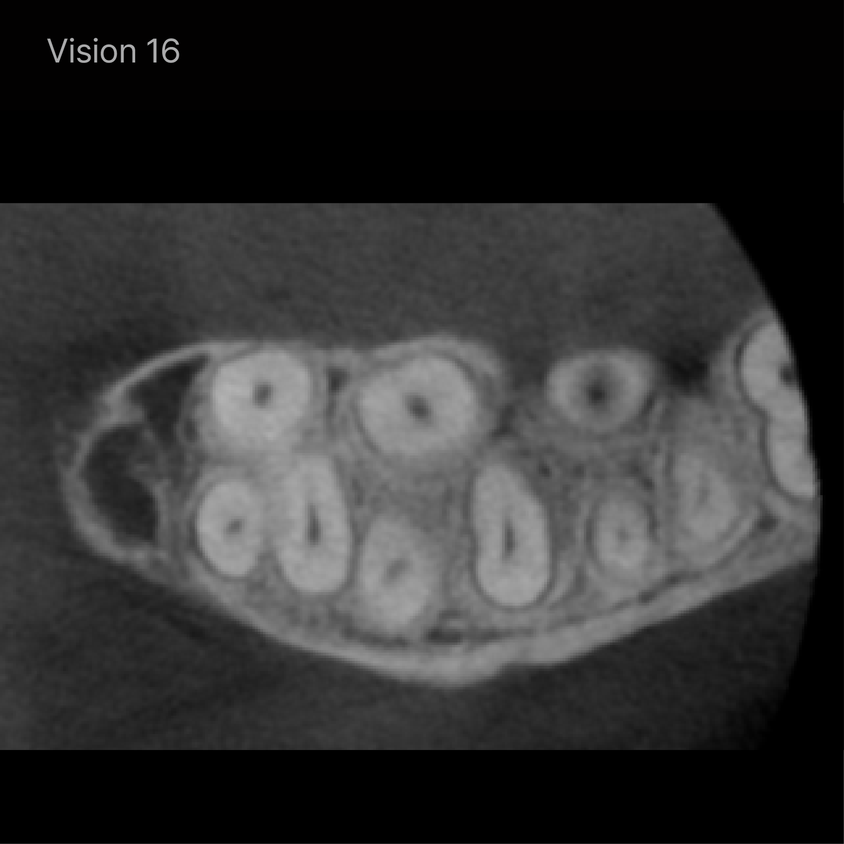 Rayscan Vision FOV 16x10 (AP160)