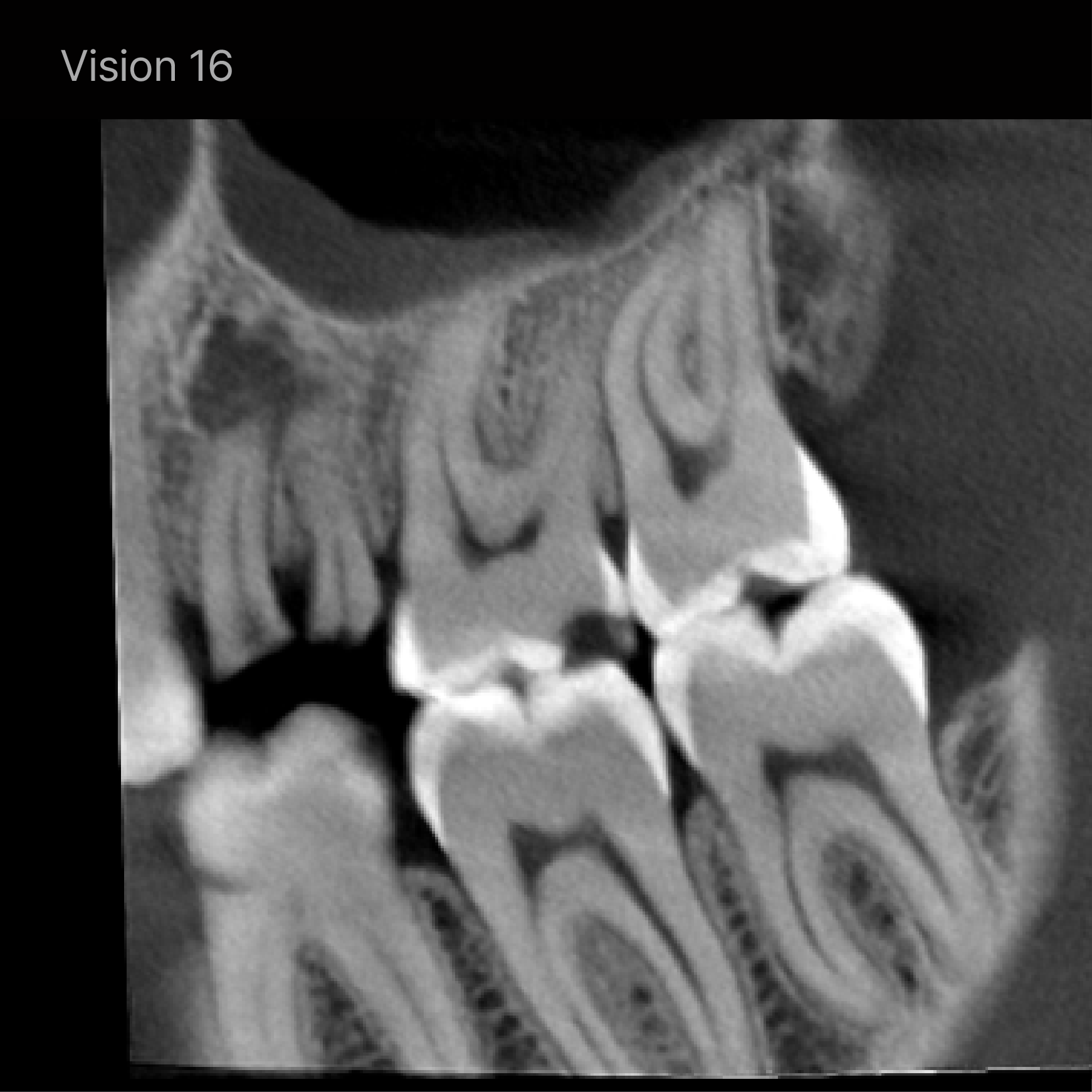 Rayscan Vision FOV 16x10 (AP160)