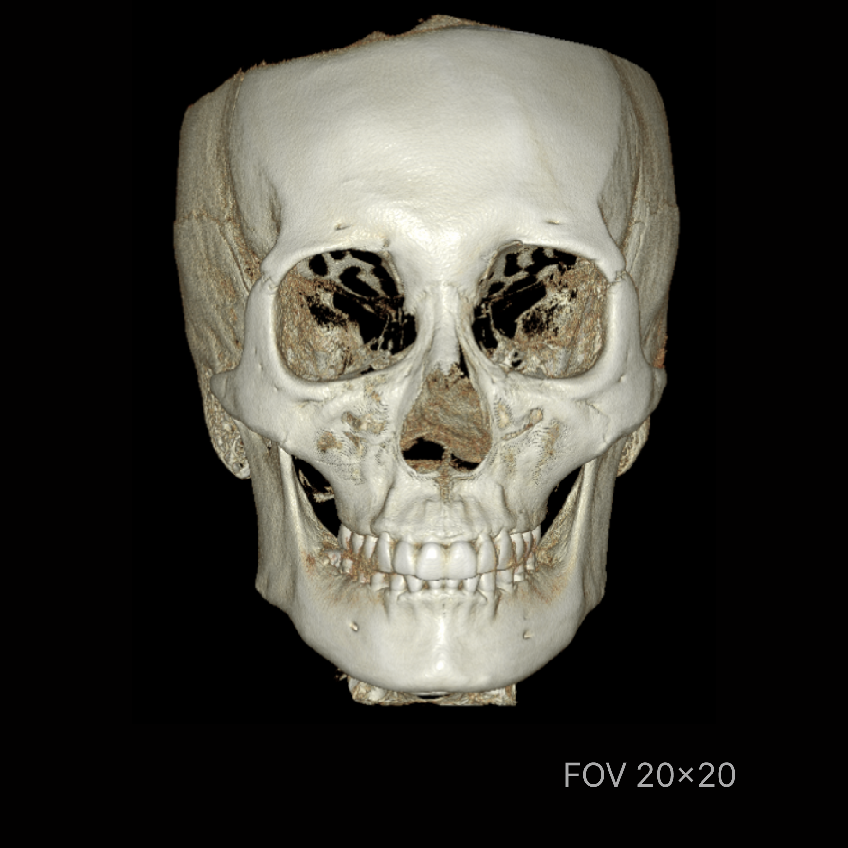 Rayscan Vision 20